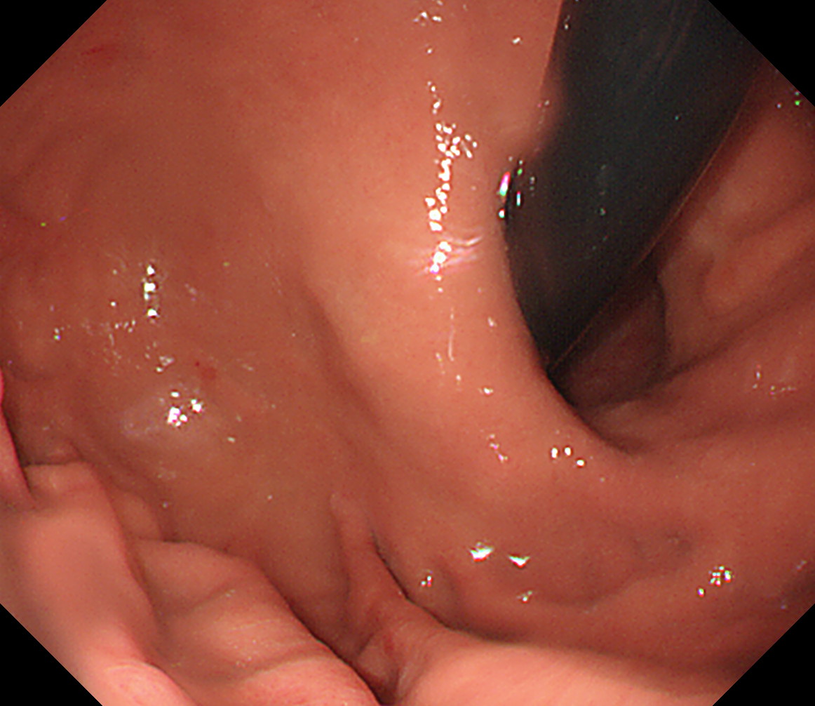 ���啔�O��